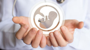 IVF STEP-BY-STEP
