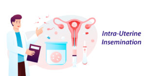 INTRA-UTERINE INSEMINATION/ IUI TREATMENT