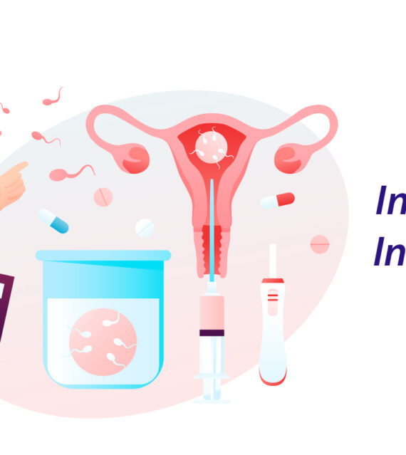 INTRA-UTERINE INSEMINATION/ IUI TREATMENT